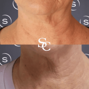 Neck Lines By Skin Club